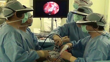 Gafas en 3D enfocadas a la cirugía